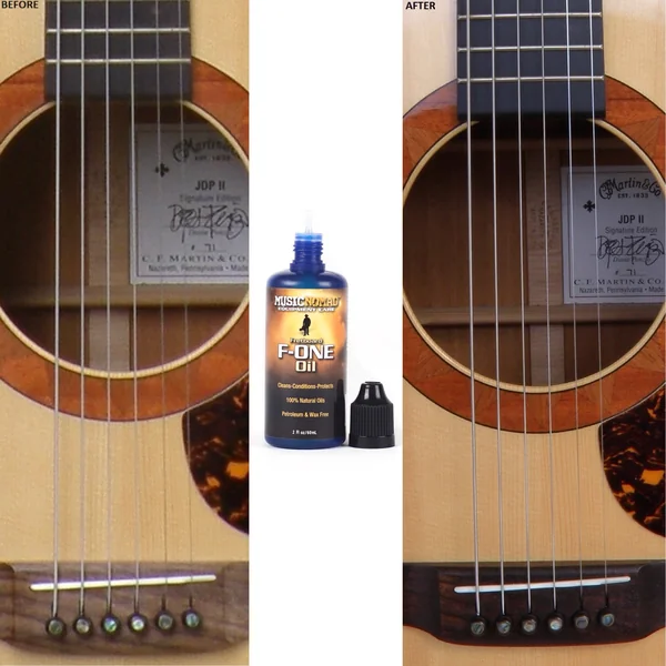 MN105 - Fretboard F-one